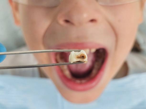 Best Pediatric Emergency Dentist in Lake Ridge, VA